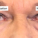 Illustration for article titled MITs Invisible Second Skin Cream Makes Wrinkles Disappear